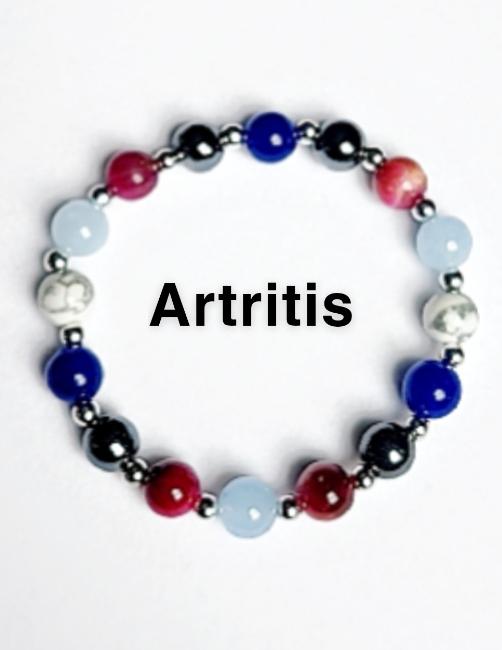 ARTRITIS