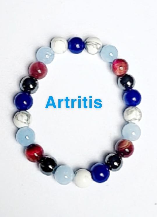 ARTRITIS PIEDRA NATURAL